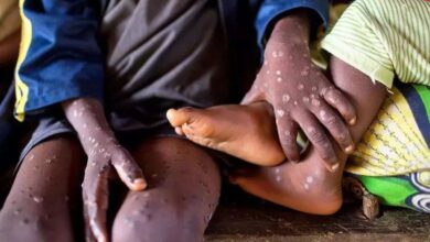 OMS declara emergencia mundial por brote de mpox