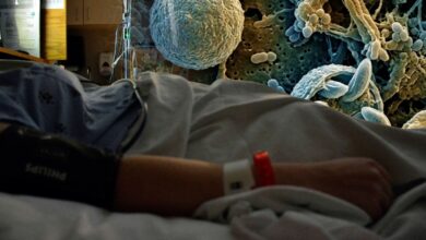 Confirman dos muertes en EU por brote de ciclosporiasis